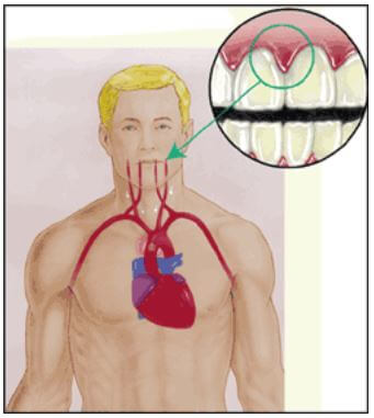 heart-disease